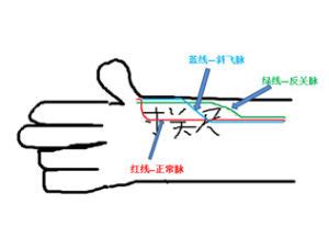 斜飛脈